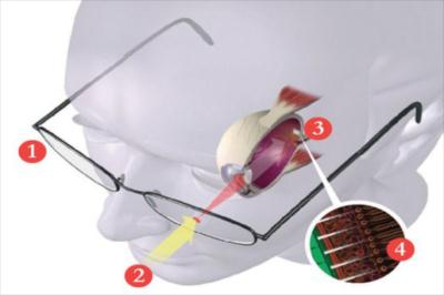 implante-ocular-bionico-da-visao-a-cegos